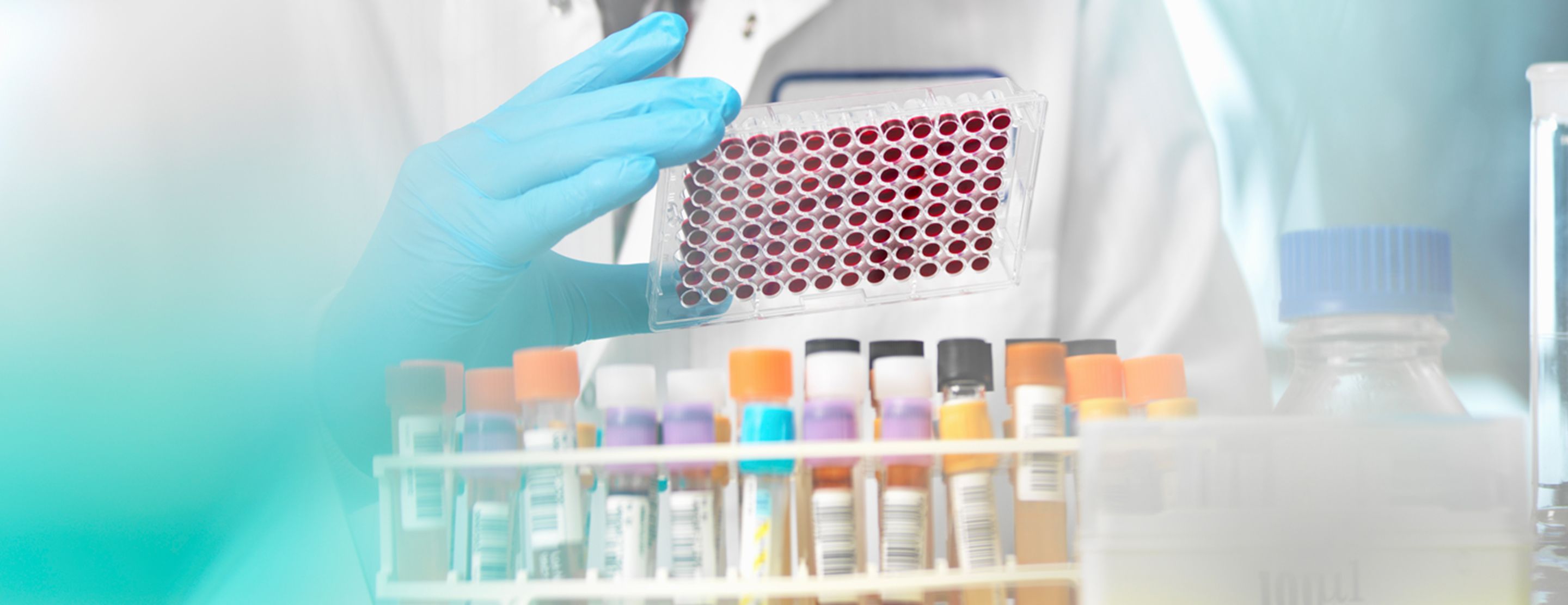 Chromium - blood test | UCSF Health