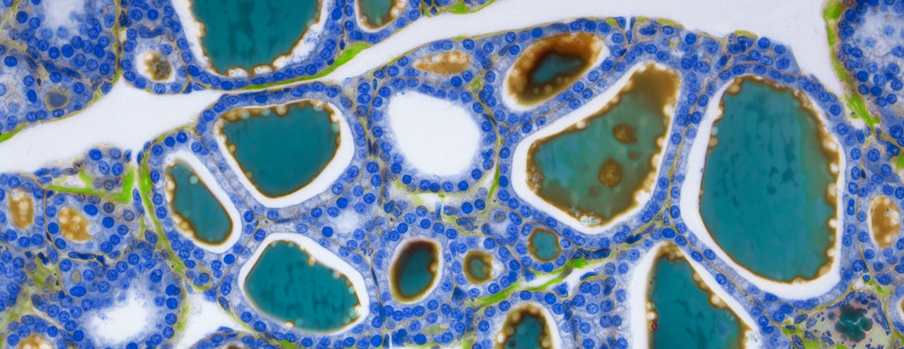 TSI test | UCSF Health