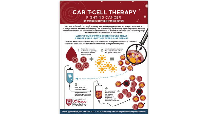 CAR T-cell therapy infographic