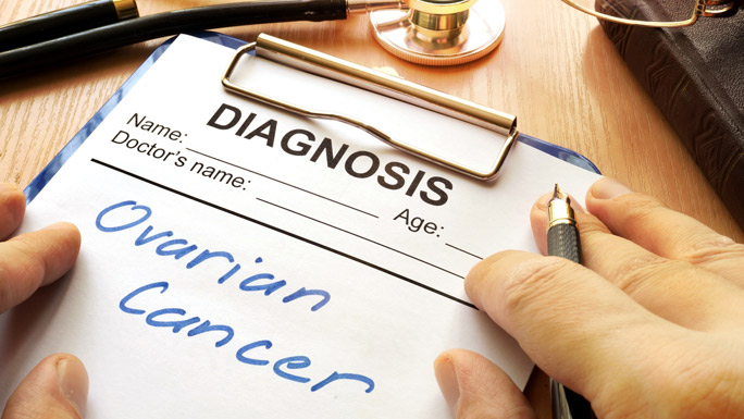diagnosis ovarian cancer