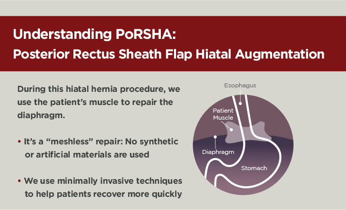 The newest hiatal hernia repair surgery