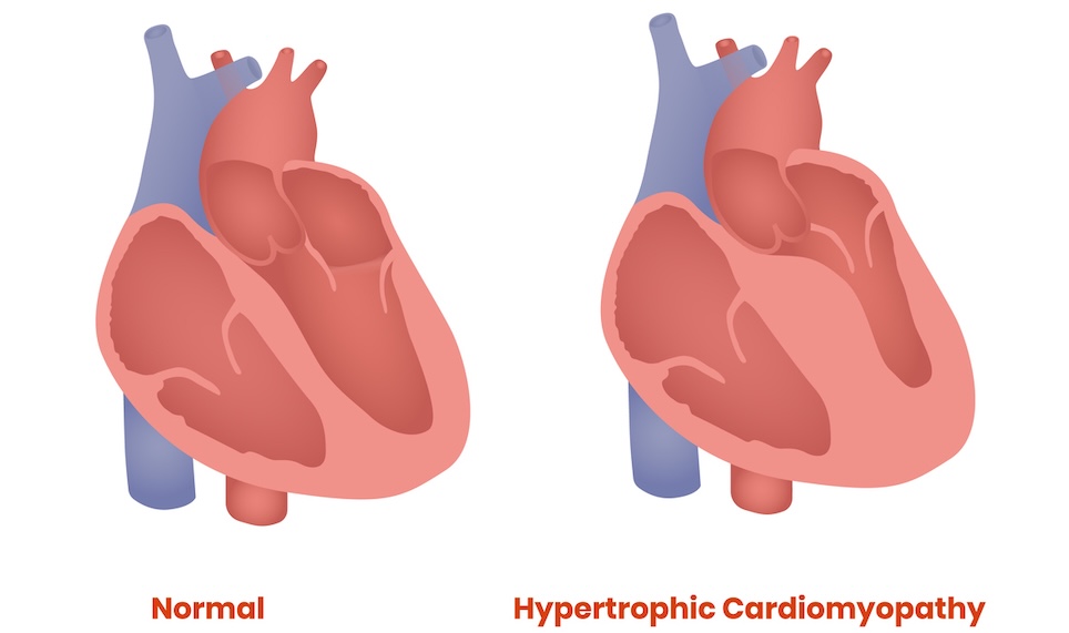Physician listens to patients lungs