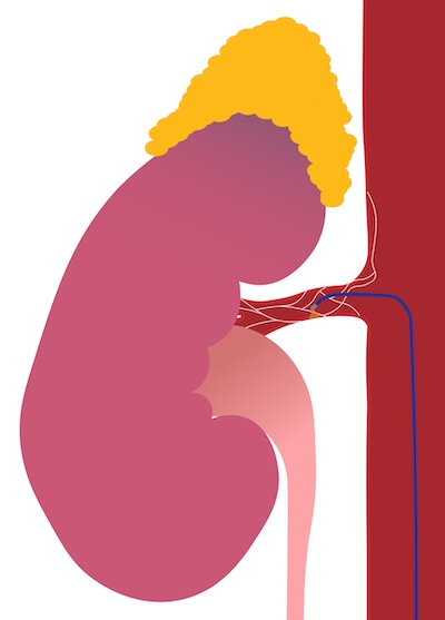 renal denervation illustration