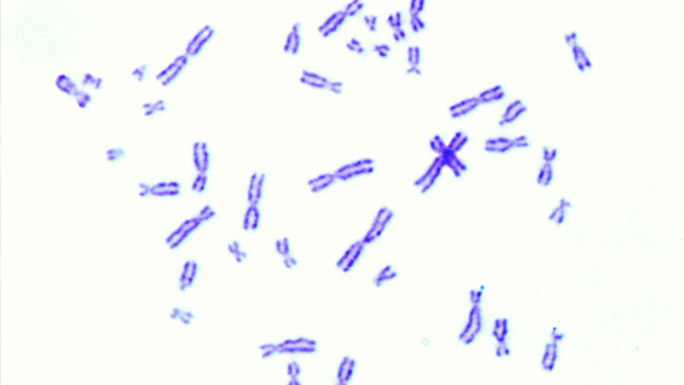 karotype, chromosomes