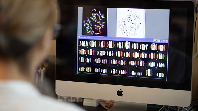 researcher looking at karyotype of chromosomes on computer