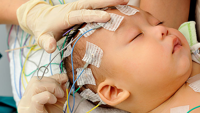  Gloved hands placing EEG electrodes on baby's head 
