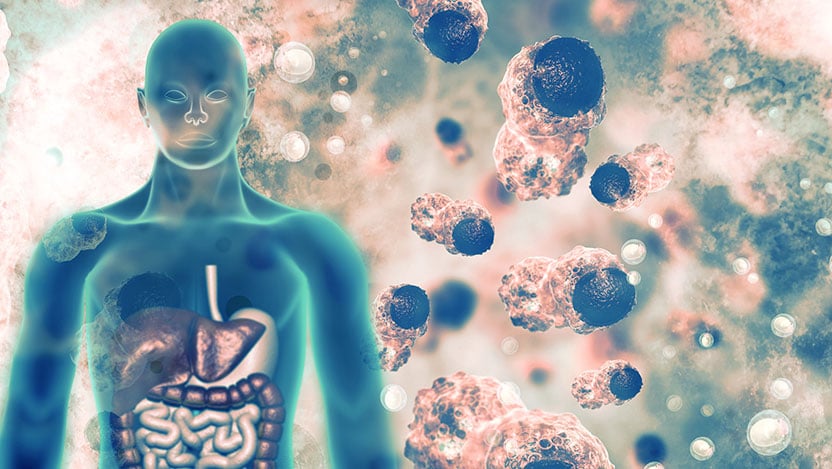 How the environment is silently shaping your risk for cancer