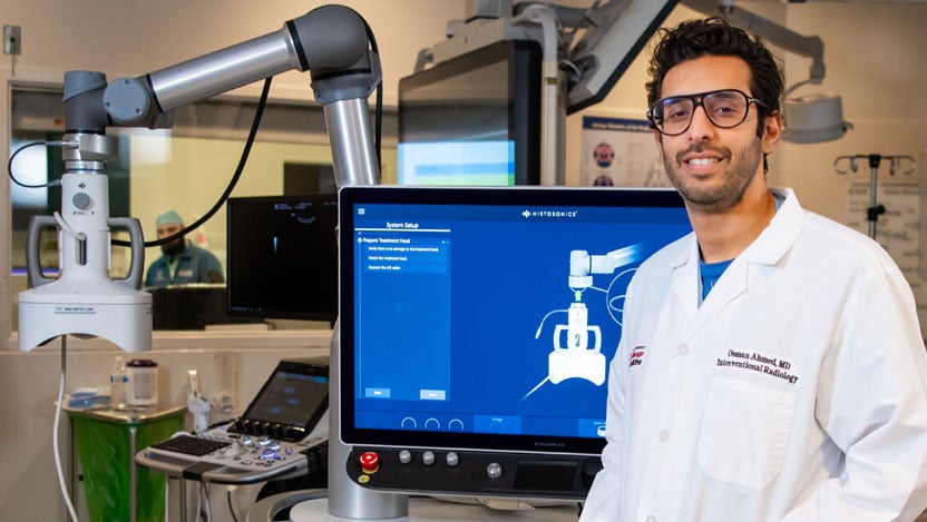 UChicago Medicine among the first to offer histotripsy for liver tumors