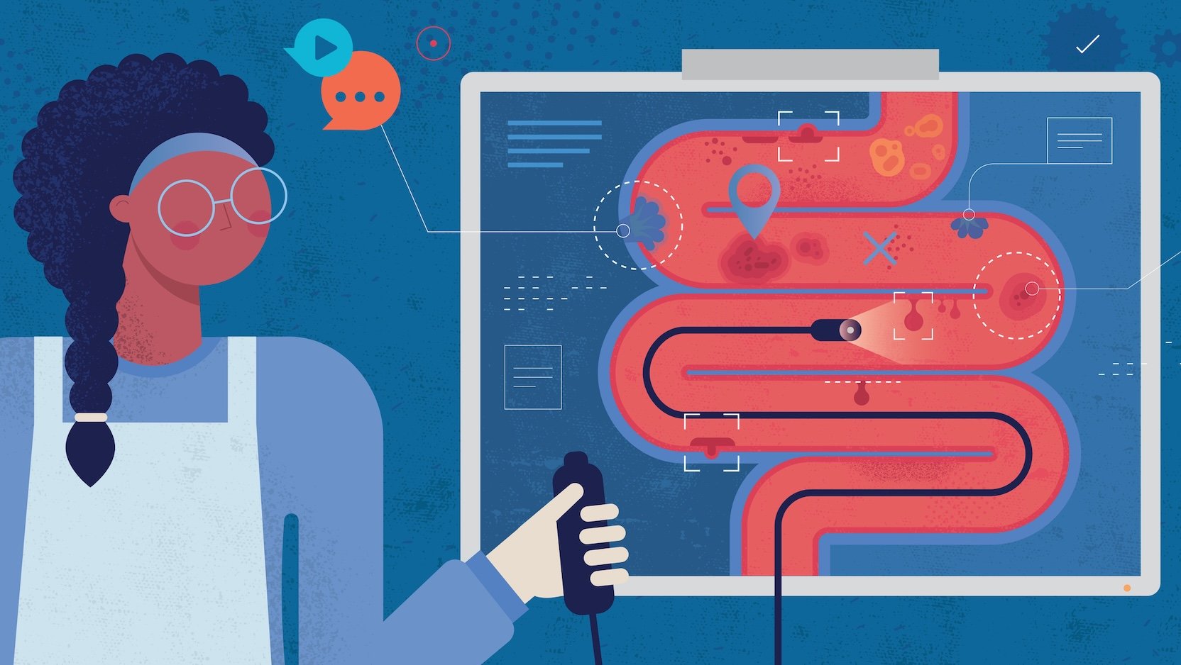 Which colonoscopy prep is best for you?