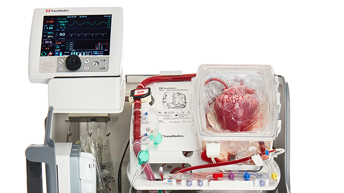 Transmedics organ technology
