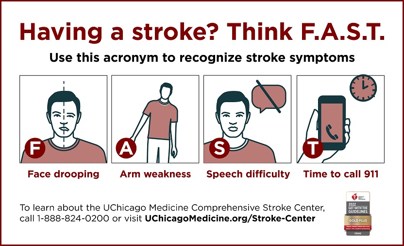 infographic entitled Having a stroke? Think F.A.S.T. Face drooping, Arm weakness, Speech difficulty, Time to call 911. To learn more about the UChicago Medicine Comprehensive Stroke Center, call 1 888 824 0200 or visit UChicagoMedicine dot org slash stroke hyphen center