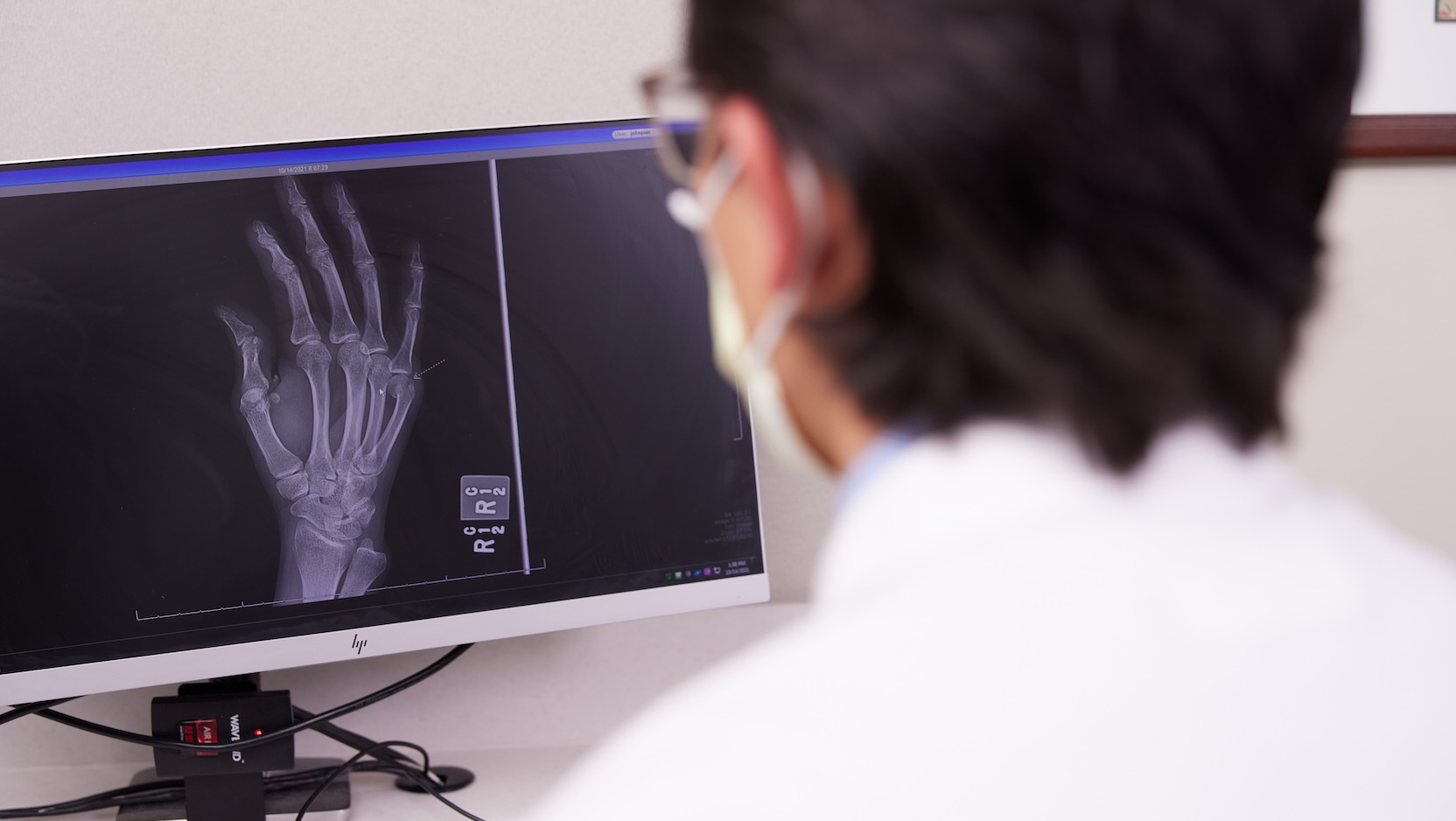 UCM physician looking at x-ray of hand