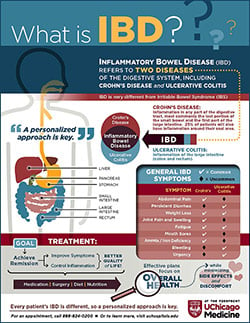 IBD inforgraphic explaining difference between Crohns and ulcerative colitis