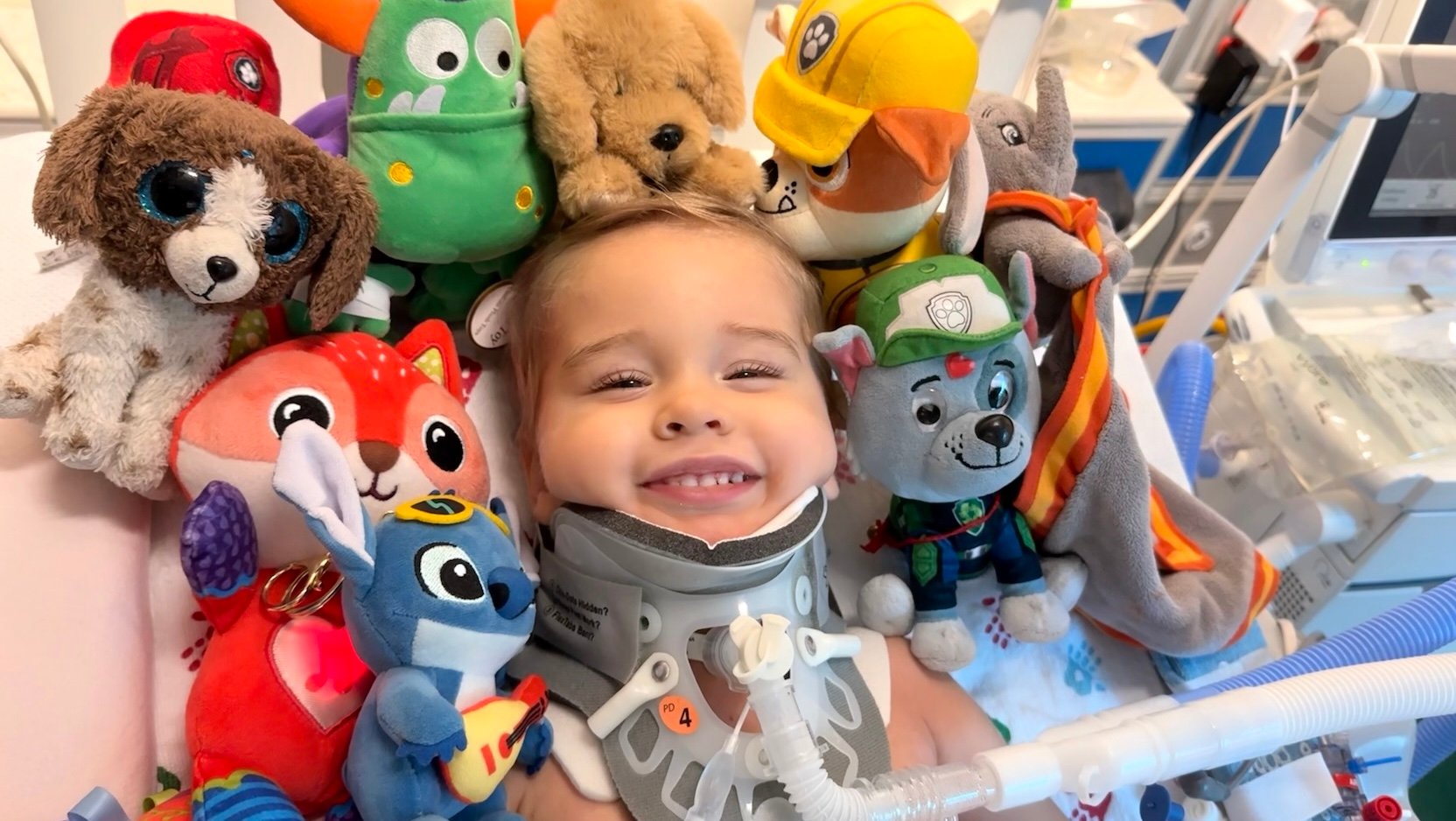 UChicago Medicine surgeons perform 'miraculous' reattachment of 2-year-old's severed spinal cord