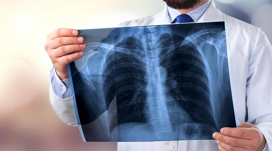 Doctor examining X-ray