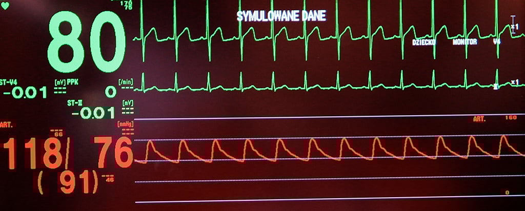 gettyimages533672125blogdetail